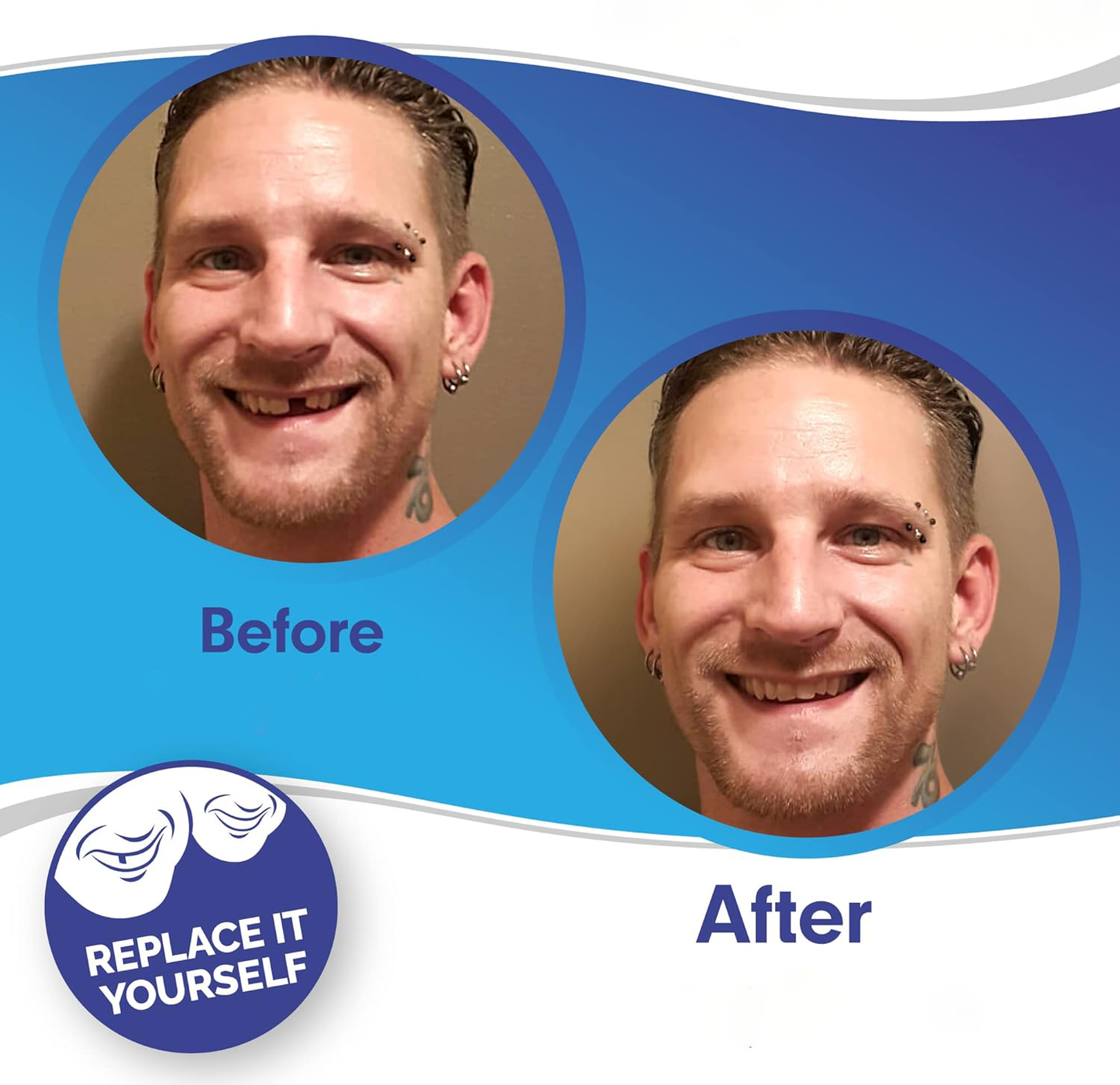 Snap-On Veneers (Upper & Lower Set) — A Flawless, Confident Smile in Seconds, No Dentist Needed
