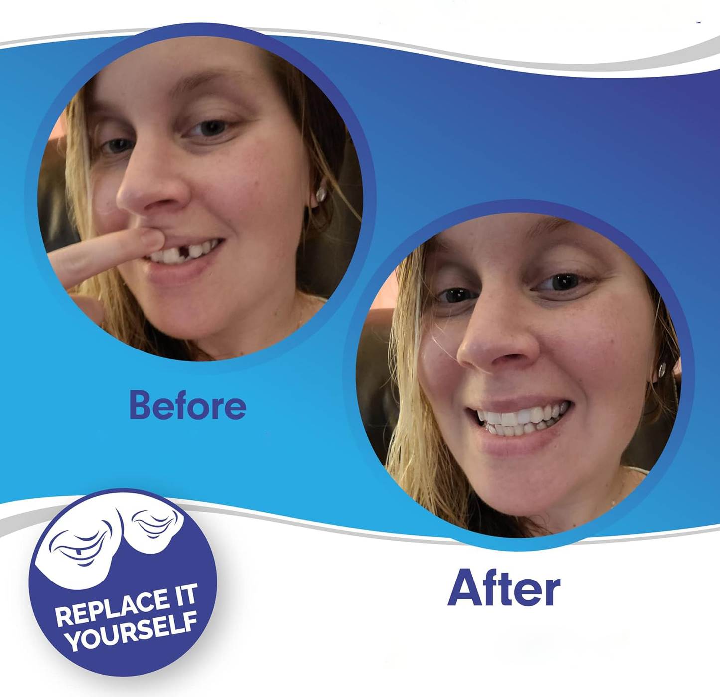 Snap-On Veneers (Upper & Lower Set) — A Flawless, Confident Smile in Seconds, No Dentist Needed
