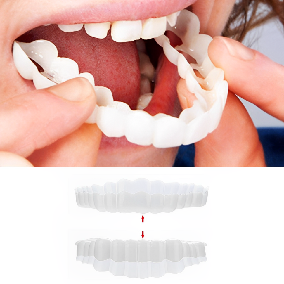 Snap-On Veneers (Upper & Lower Set) — A Flawless, Confident Smile in Seconds, No Dentist Needed