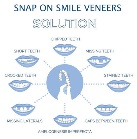 Snap-On Veneers (Upper & Lower Set) — A Flawless, Confident Smile in Seconds, No Dentist Needed